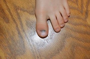 Защо ноктите на крака ми станаха черни, но не боли?