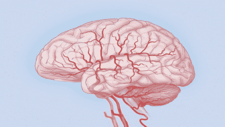 Какво представлява церебралната исхемия и как се лекува?