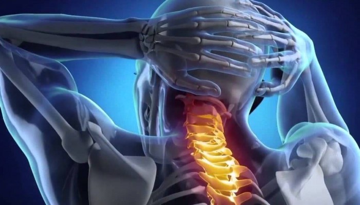Сблъсъци и фрактури на гръбнака: симптоми, класификация, лечение