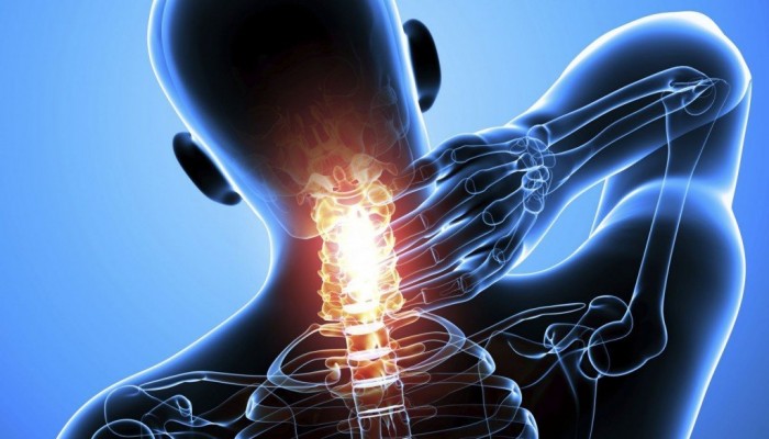 Хондроза на гръбначния стълб: симптоми и принципи на лечение