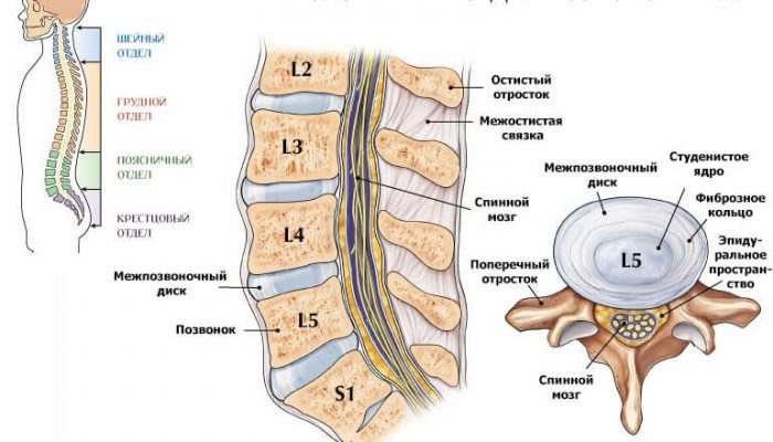 Дискогенна радикулопатия на лумбосакралния гръбначен стълб