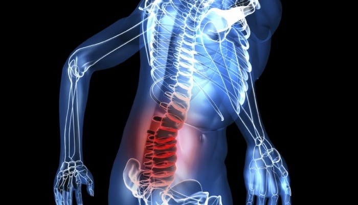 Перинеурална киста на гръбнака: симптоми и лечение