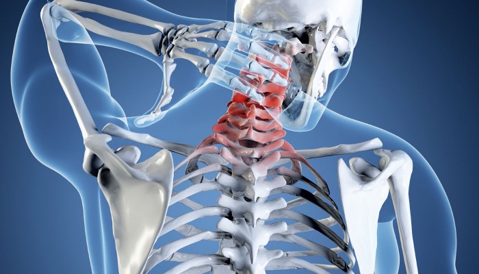 Симптоми и лечение на не-гръбначна артроза на гръбначния стълб