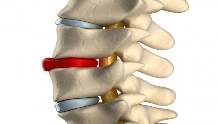 Каква е изпъкналата част на гръбначния стълб?