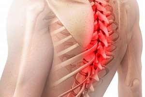 Дискогенна радикулопатия на различни части на гърба