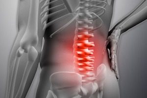 Методи на декомпресия при лечението на различни заболявания на гръбначния стълб