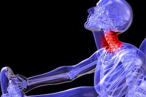 Ротационна травма на гръбнака: как изглежда и какво е опасно