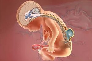 Патологията на нервната тръба: как да се избегне диагнозата на бифидното центрофугиране