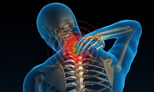 Симптомите и лечението на компресионната миелопатия на шийката на гръбначния стълб