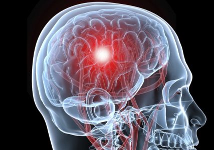 Защо се развива и как се развива мозъчният хидроцефализъм при възрастен?