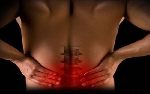 Спондилоза на гръбнака: симптоми, причини, лечение