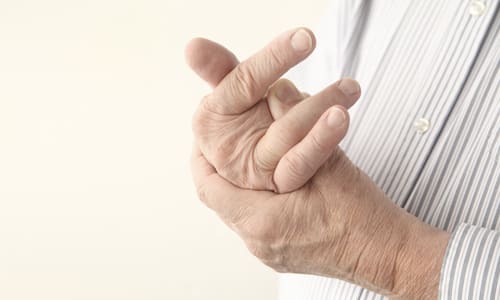 Как и какъв е най-добрият начин за лечение на артрит на ръцете?