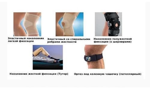 Как да изберем правилното ортопедично коляно, когато артрозата на колянната става?