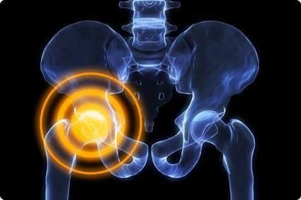Как да определите причината за болката в тазобедрените и тазовите кости