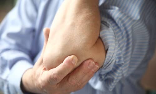 Основни симптоми и лечение на лакътния артрит