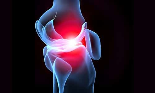 Причини, симптоми и лечение на артралгия на колянните и тазобедрените стави