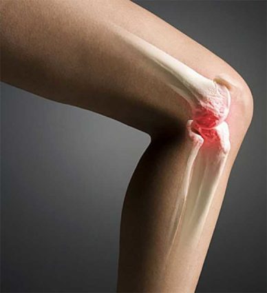 Болки в ставите: защо болката в коляното?