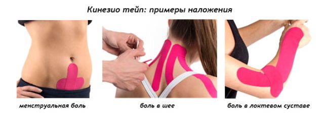 Kinesio teip - лечебна профилактика за мускули и стави