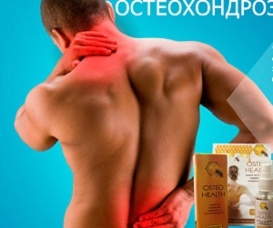 Спрей Osteo Health ще облекчи болката и други прояви на остеохондроза