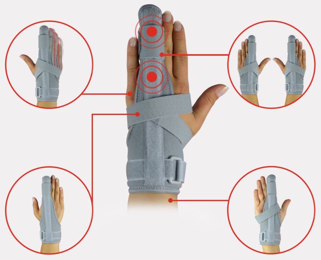 Фиксатори за пръстите и пръстите на краката - когато имате нужда от ортезия и когато гумата или превръзката?
