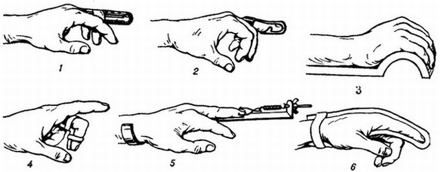 Фиксатори за пръстите и пръстите на краката - когато имате нужда от ортезия и когато гумата или превръзката?