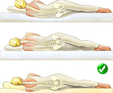 Как да изберем ортопедична възглавница под главата си и да спим правилно върху нея
