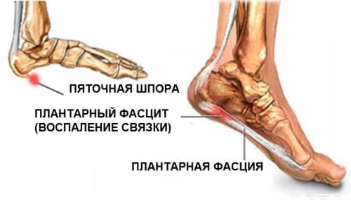 Как да изберем ортопедични подложки за обувки за мъже и жени?