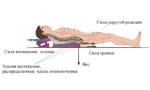 Видове, индикации и противопоказания за използването на симулатори за удължаване на гръбначния стълб