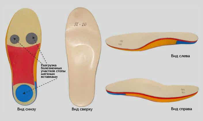 Какви са и защо ортопедичните стелки за обувки?