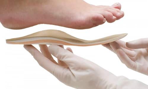 Кои ортопедични стелки и опори са необходими за надлъжните напречни плоски крака?