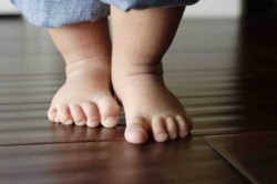 Ортопедични обувки за деца с деформации на валгус на крака: какво е това?