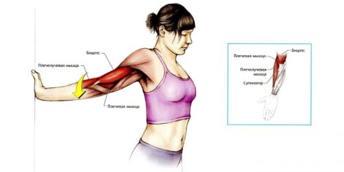 Как да се третира разтягането на сухожилията и мускулите на ръката