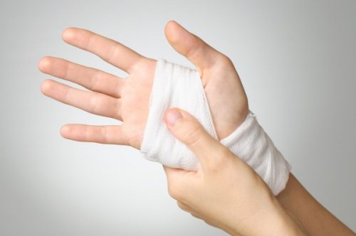Как да се третира разтягането на сухожилията и мускулите на ръката