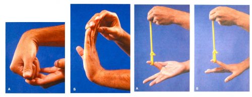 Признаци на изкълчване на сухожилията на палеца и други пръсти