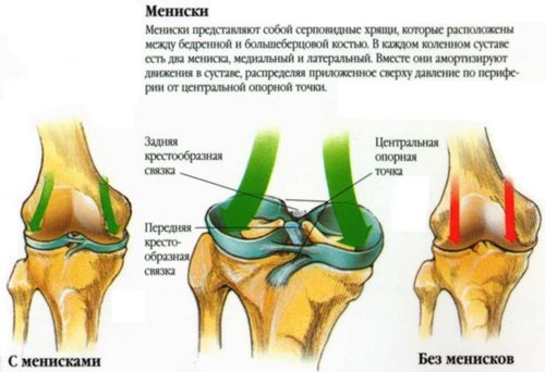 Симптоми на дегенеративни увреждания на менискуса на коляното