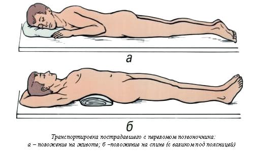 Симптоми, първа помощ, транспортиране и лечение на компресионна фрактура на гръбначния стълб
