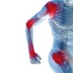 Артрит в ставите и костите: причините и лечението на болката