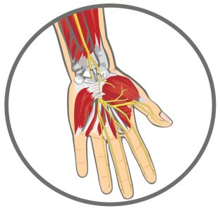 Причини, симптоми, начини за лечение на навяхвания и мускули на ръката