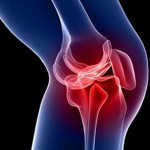 Увреждане на менискуса на колянната става: симптоми (признаци и снимки), лечение, причини