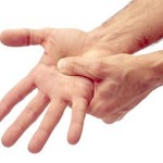 Дислокация на пръст върху ръката (голям, малък пръст, анонимен): какво да правите и как да коригирате стречинг у дома