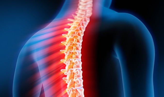 Фрактура на гръбначния стълб: лечение и последици