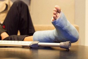 Как да премахнете отока след счупване на крака