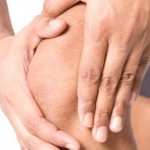 Как да се лекува разместване на колянната става: как да коригирате коляното, причините за подуване на чашата на колянната става