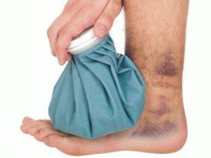 Как да лекувате нараняване на крака с оток