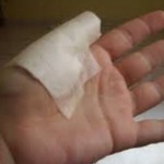 Увреждане на ставата на пръста: какво да се направи, лечение на палеца нараняване