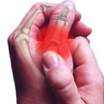 Увреждане на ставата на пръста: какво да се направи, лечение на палеца нараняване