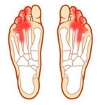 Спирачката от дъното близо до пръстите боли: защо болките боли, отколкото да лекуват крака