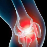 Болка в коляното при ходене: причини и лечение на колянната става