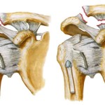 Болка в лявото рамо: защо рамото боли, какво да правим и как да се отнасяме към ръката