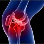 Болка под патела: защо боли какво да прави с болка в коляното